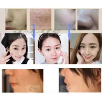 Caicui احاطة ماكياج العناية بالوجه مستحضرات التجميل الكورية bb cc dd كريم المخفي ترطيب تبييض سطع - الصورة 6